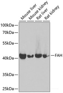 Western blot analysis of extracts of various cell lines using FAH Polyclonal Antibody at dilution of 1:1000.