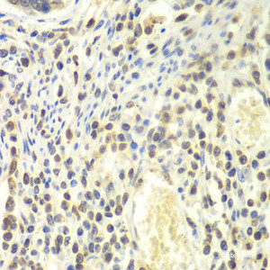 Immunohistochemistry of paraffin-embedded Human colon using PSMA4 Polyclonal Antibody at dilution of 1:100 (40x lens) .