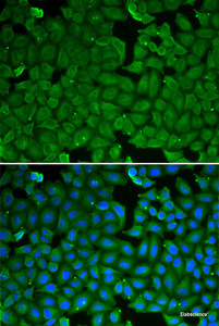 Immunofluorescence analysis of HeLa cells using SPINK1 Polyclonal Antibody