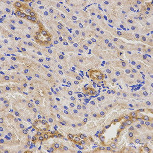 Immunohistochemistry of paraffin-embedded Rat kidney using TNFRSF1B Polyclonal Antibody at dilution of 1:200 (40x lens) .