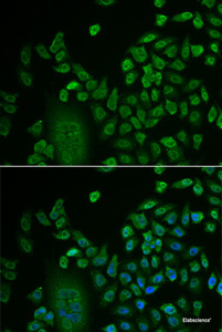 Immunofluorescence analysis of HeLa cells using LSM4 Polyclonal Antibody at dilution of 1:50. Blue: DAPI for nuclear staining.