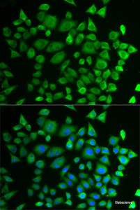 Immunofluorescence analysis of HeLa cells using P4HTM Polyclonal Antibody
