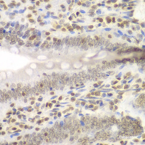 Immunohistochemistry of paraffin-embedded Rat Intestine using UHRF2 Polyclonal Antibody at dilution of 1:200 (40x lens) .