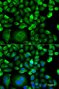 Immunofluorescence analysis of HeLa cells using MSMB Polyclonal Antibody