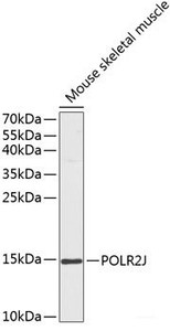 Western blot analysis of extracts of Mouse skeletal muscle using POLR2J Polyclonal Antibody at dilution of 1:1000.