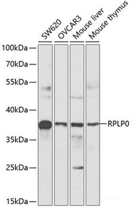 Western blot analysis of extracts of various cell lines using RPLP0 Polyclonal Antibody at dilution of 1:1000.