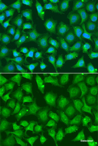 Immunofluorescence analysis of A549 cells using XRCC2 Polyclonal Antibody