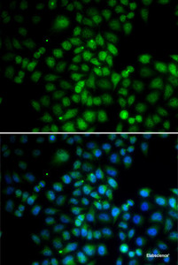 Immunofluorescence analysis of HeLa cells using C11orf30 Polyclonal Antibody