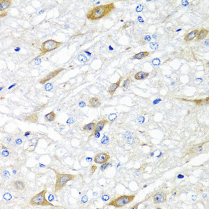 Immunohistochemistry of paraffin-embedded Rat brain using CPA6 Polyclonal Antibody at dilution of 1:100 (40x lens) .