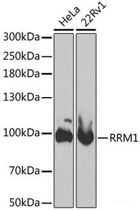 Western blot analysis of extracts of various cell lines using RRM1 Polyclonal Antibody at dilution of 1:1000.