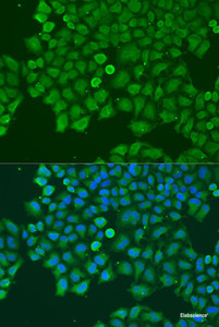 Immunofluorescence analysis of U2OS cells using CAST Polyclonal Antibody at dilution of 1:100. Blue: DAPI for nuclear staining.