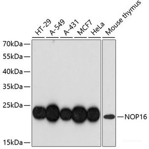 Western blot analysis of extracts of various cell lines using NOP16 Polyclonal Antibody at dilution of 1:3000.