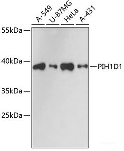 Western blot analysis of extracts of various cell lines using PIH1D1 Polyclonal Antibody at dilution of 1:3000.