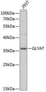 Western blot analysis of extracts of 293T cells using GLYAT Polyclonal Antibody at dilution of 1:3000.