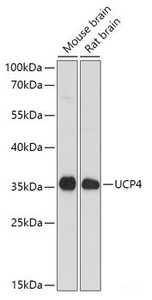 Western blot analysis of extracts of various cell lines using SLC25A27 Polyclonal Antibody at dilution of 1:1000.