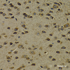 Immunohistochemistry of paraffin-embedded Mouse brain using OGG1 Polyclonal Antibody at dilution of 1:200 (40x lens) .