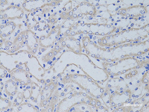 Immunohistochemistry of paraffin-embedded Mouse kidney using AQP5 Polyclonal Antibody at dilution of 1:50 (40x lens) .