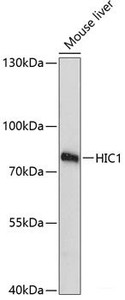 Western blot analysis of extracts of Mouse liver using HIC1 Polyclonal Antibody at dilution of 1:3000.