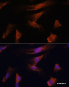 Immunofluorescence analysis of U2OS cells using ADA Polyclonal Antibody at dilution of 1:100. Blue: DAPI for nuclear staining.