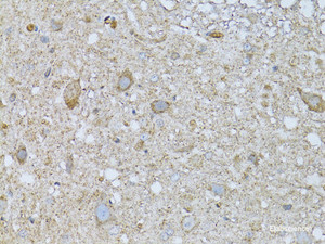 Immunohistochemistry of paraffin-embedded Rat spinal cord using PHLDA2 Polyclonal Antibody at dilution of 1:100 (40x lens) .