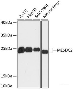 Western blot analysis of extracts of various cell lines using MESDC2 Polyclonal Antibody at dilution of 1:3000.