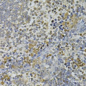 Immunohistochemistry of paraffin-embedded Rat spleen using CEBPE Polyclonal Antibody at dilution of 1:100 (40x lens) .