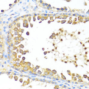 Immunohistochemistry of paraffin-embedded Rat testis using DAZL Polyclonal Antibody at dilution of 1:100 (40x lens) .