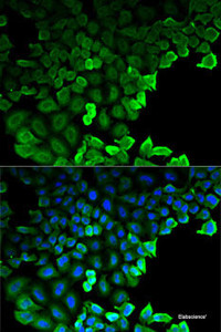 Immunofluorescence analysis of HeLa cells using G6PD Polyclonal Antibody