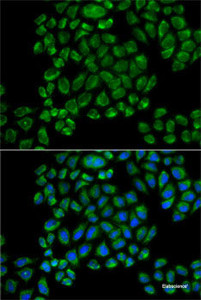 Immunofluorescence analysis of HeLa cells using GRIA3 Polyclonal Antibody