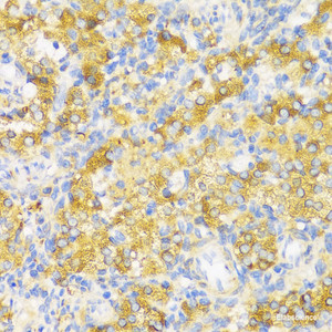 Immunohistochemistry of paraffin-embedded Rat ovary using HLA-DPB1 Polyclonal Antibody at dilution of 1:100 (40x lens) .