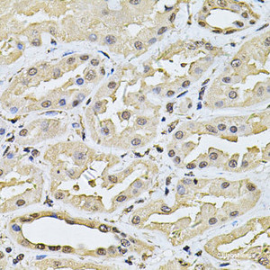 Immunohistochemistry of paraffin-embedded Human kidney using SP110 Polyclonal Antibody at dilution of 1:100 (40x lens) .