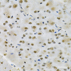 Immunohistochemistry of paraffin-embedded Rat brain using OTX2 Polyclonal Antibody at dilution of 1:100 (40x lens) .