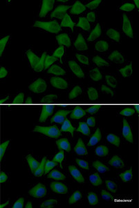 Immunofluorescence analysis of U2OS cells using PLOD2 Polyclonal Antibody