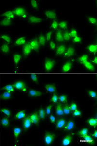 Immunofluorescence analysis of HeLa cells using AKAP5 Polyclonal Antibody at dilution of 1:100. Blue: DAPI for nuclear staining.