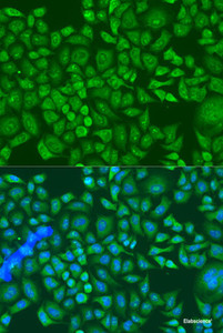 Immunofluorescence analysis of U2OS cells using IGF2BP2 Polyclonal Antibody at dilution of 1:100. Blue: DAPI for nuclear staining.