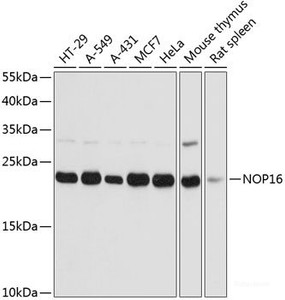 Western blot analysis of extracts of various cell lines using NOP16 Polyclonal Antibody at dilution of 1:3000.