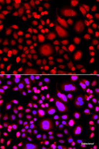 Immunofluorescence analysis of A549 cells using PRKAG3 Polyclonal Antibody