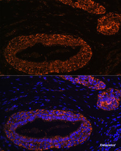 Immunofluorescence analysis of Human breast using RNF31 Polyclonal Antibody at dilution of 1:100 (40x lens) . Blue: DAPI for nuclear staining.