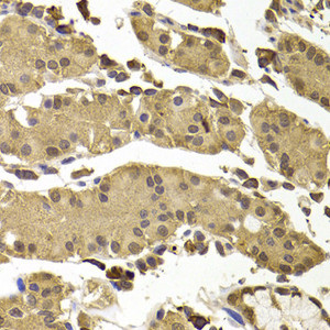 Immunohistochemistry of paraffin-embedded Human stomach using SETD5 Polyclonal Antibody at dilution of 1:100 (40x lens) .