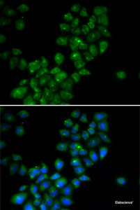 Immunofluorescence analysis of HeLa cells using CANT1 Polyclonal Antibody