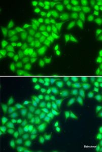 Immunofluorescence analysis of MCF-7 cells using METTL2A Polyclonal Antibody