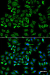 Immunofluorescence analysis of HeLa cells using HP Polyclonal Antibody