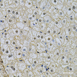 Immunohistochemistry of paraffin-embedded Human liver damage using NRF1 Polyclonal Antibody at dilution of 1:100 (40x lens) .
