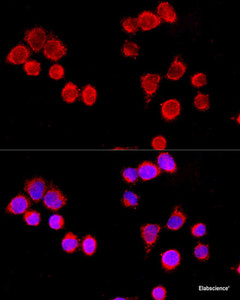 Immunofluorescence analysis of HeLa cells using CYP3A4 Polyclonal Antibody at dilution of 1:100 (40x lens) . Blue: DAPI for nuclear staining.