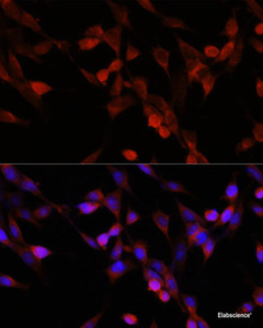 Immunofluorescence analysis of NIH/3T3 cells using UBIAD1 Polyclonal Antibody at dilution of 1:100. Blue: DAPI for nuclear staining.