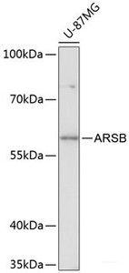 Western blot analysis of extracts of U-87MG cells using ARSB Polyclonal Antibody at dilution of 1:3000.