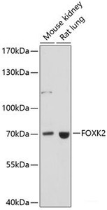 Western blot analysis of extracts of various cell lines using FOXK2 Polyclonal Antibody at dilution of 1:1000.