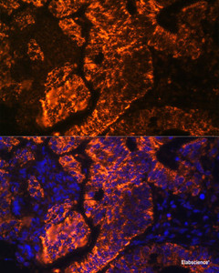 Immunofluorescence analysis of Human colon carcinoma cells using TNFRSF25 Polyclonal Antibody at dilution of 1:100. Blue: DAPI for nuclear staining.
