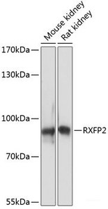 Western blot analysis of extracts of various cell lines using RXFP2 Polyclonal Antibody at dilution of 1:3000.