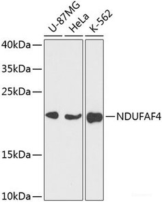 Western blot analysis of extracts of various cell lines using NDUFAF4 Polyclonal Antibody at dilution of 1:3000.